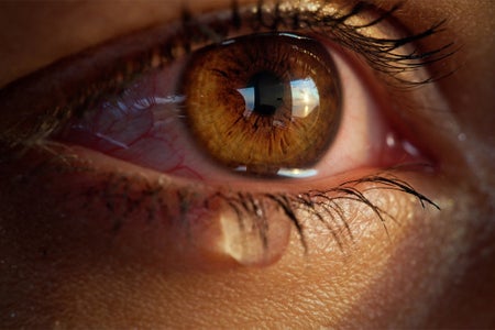 Extreme closeup on bright brown eye shedding a tear